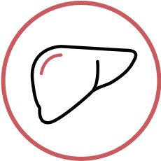 Hepatic complications of GSDIa